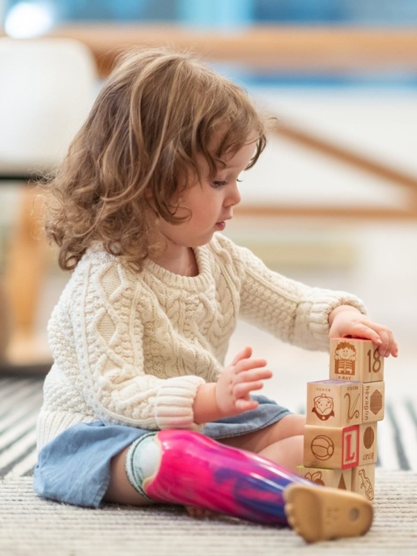 Occupational therapist helps a little girl with a prosthetic leg 